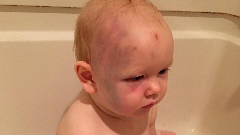 Bebé lo golpea su papá tras discusión con su pareja, el menor estuvo a punto de morir