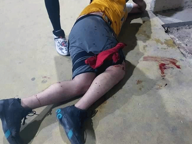 Un hombre de aproximadamente 50 años y de origen Israelí, fue atacado a balazos cuando jugaba basquetbol en el parque a la Madre.