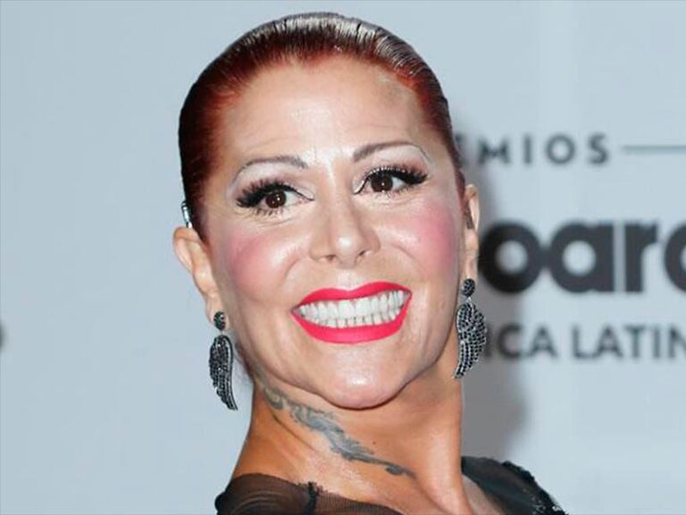 Alejandra Guzmán, la destrozan en redes por exceso de bótox - Turquesa News