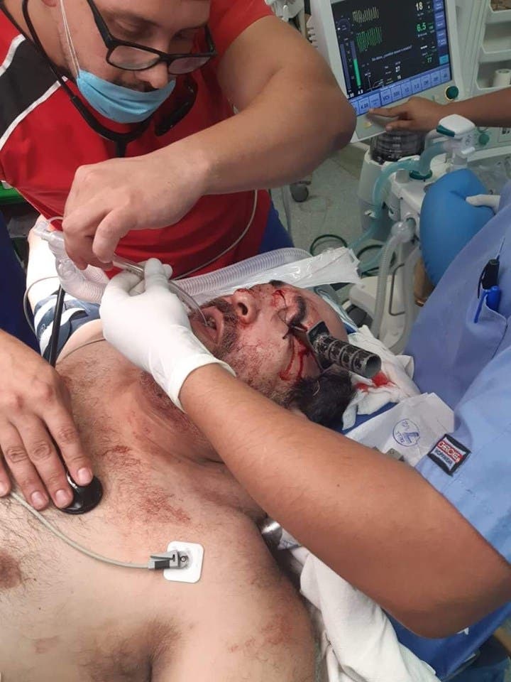 Esta tarde un hombre terminó con una navaja en el ojo, debido a que peleaba con otra persona, un lugar en el estacionamiento.