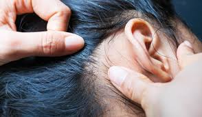 Debido al intenso calor, los piojos se reproducen en mayores cantidades