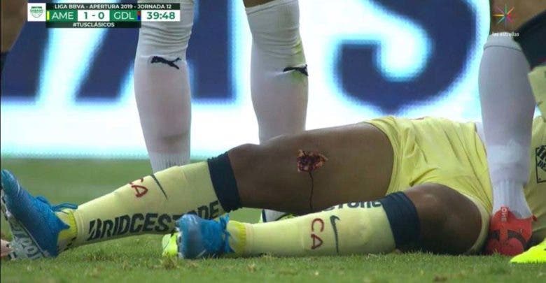¡Impactante! Giovani Dos Santos sufrió grave lesión en el Clásico América vs Chivas