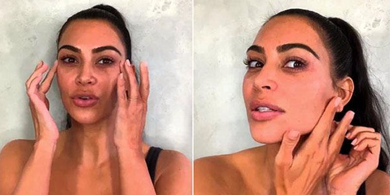 Kim Kardashian muestra cómo su enfermedad le cambió la cara