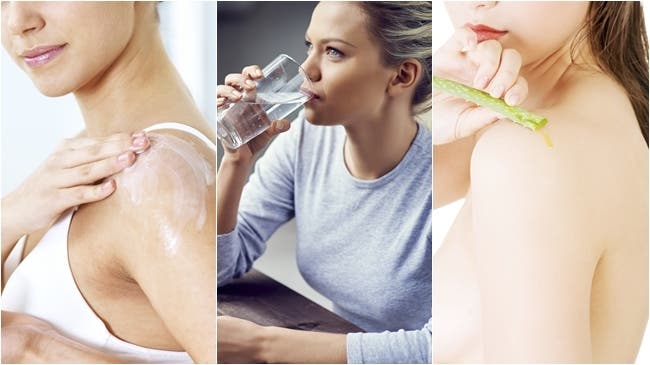 Remedios Caseros | Alivia las quemaduras de sol en la piel