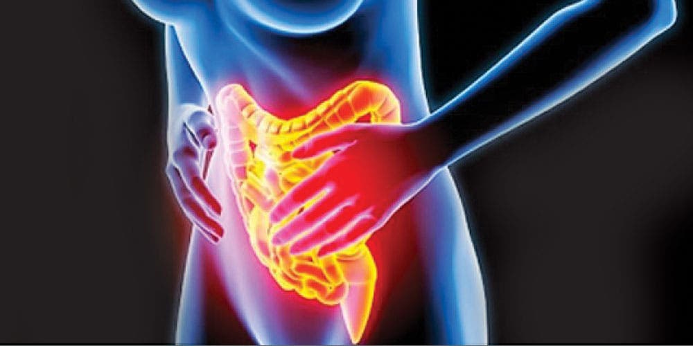 Remedios caseros para eliminar la Colitis, fácil y rápido