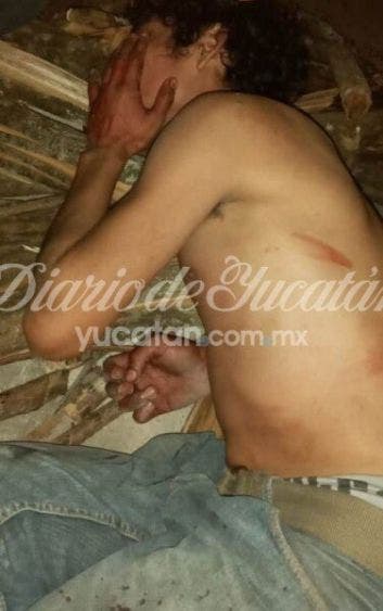 Sobrino que recibió un machetazo en el pómulo izquierdo.- Foto: Diario de Yucatán