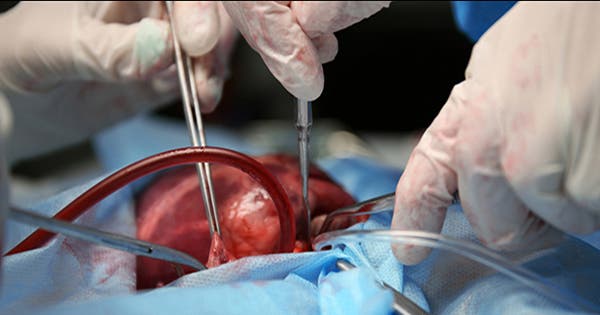 27 de febrero: Día Internacional del Trasplante