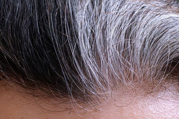 Olvídate de las canas con este remedio casero a base de bicarbonato