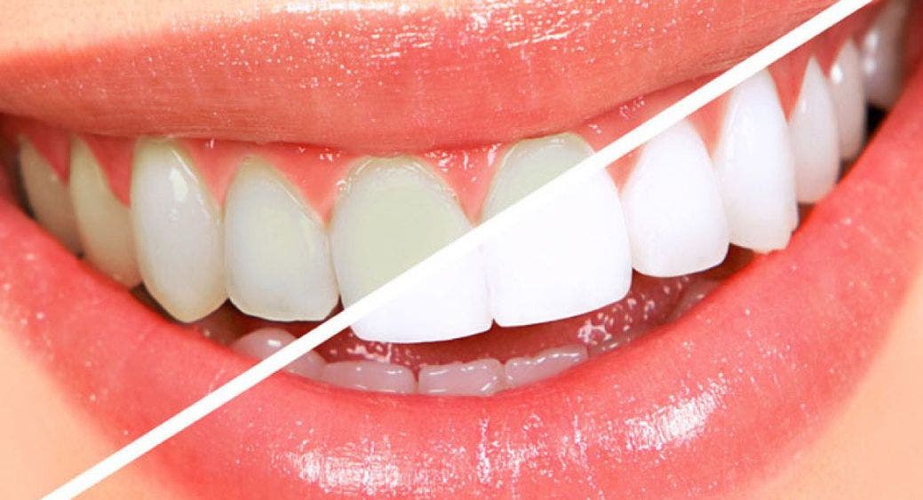 Usos del agua oxigenada en tu cuidado personal