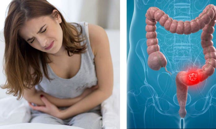 Consejos fáciles y caseros para combatir el estreñimiento