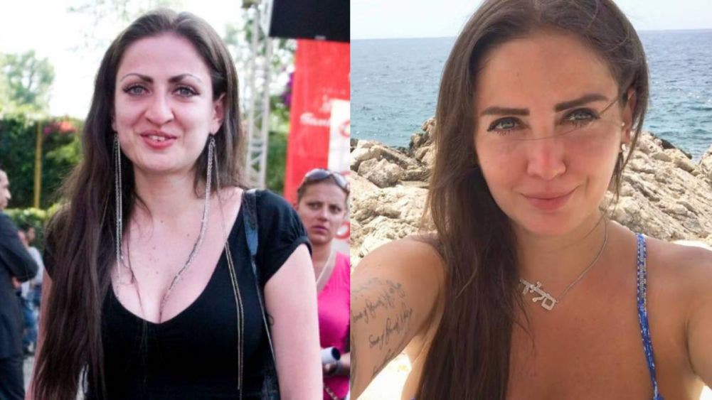 Celia Lora: Las operaciones que la volvieron atractiva