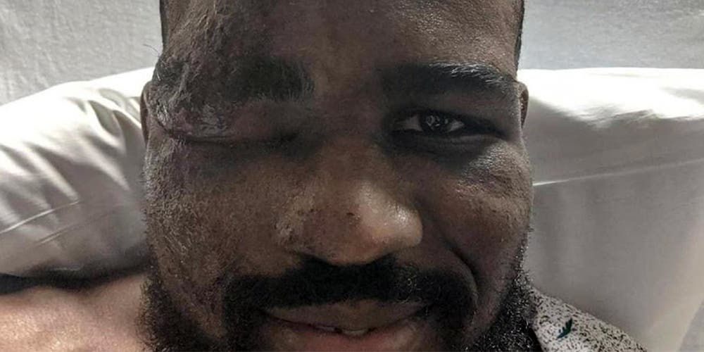 Luchador cuenta cómo su corazón dejó de latir