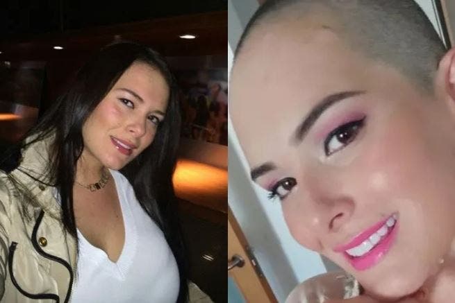 Atacan a mujer con pegamento y se queda sin cabello