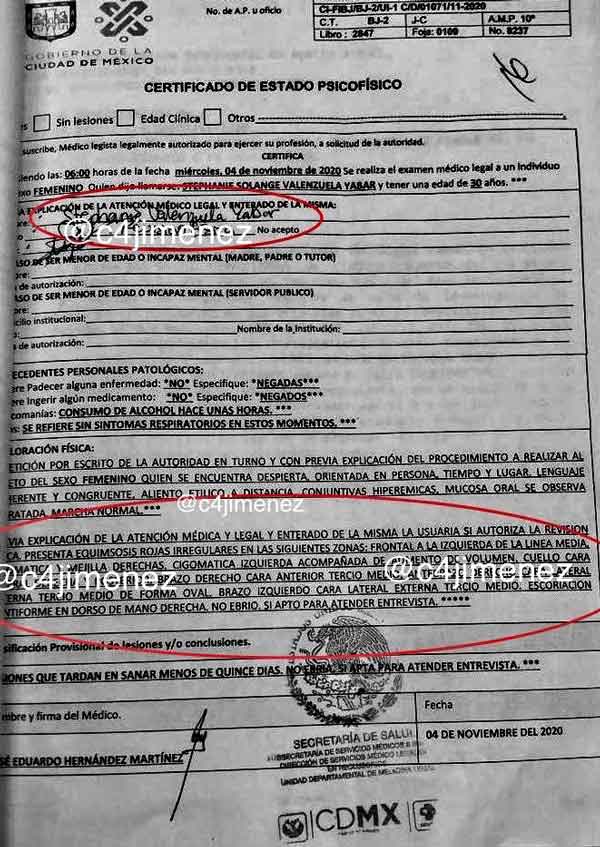 Eleazar “N” sí golpeó a Tefi, estudio médico lo confirma