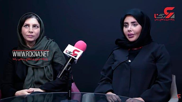 La "Angelina Jolie" zombie sale de la cárcel y luce irreconocible