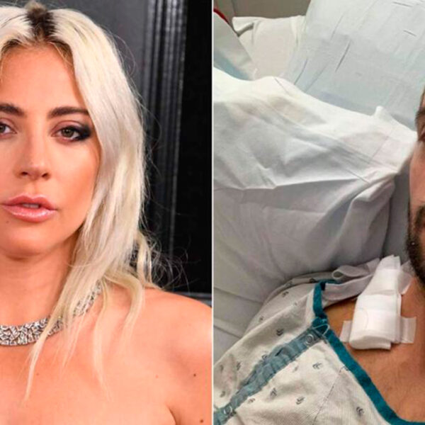 Cuidador de perros de Lady Gaga revela tener perforado un pulmón