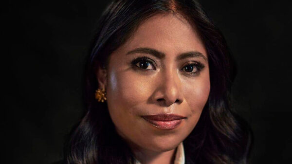 Yalitza Aparicio revela tener terrible enfermedad en la piel