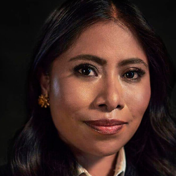 Yalitza Aparicio revela tener terrible enfermedad en la piel