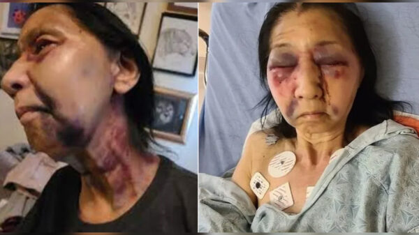 Joven racista en EU destroza a golpes a abuelita méxicoamericana