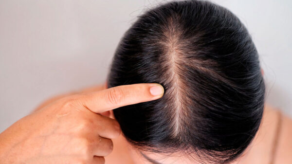 ¿Sufres de caída del cabello? Te presentamos este remedio natural, ¡chécalo!