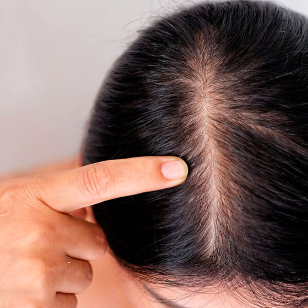 ¿Sufres de caída del cabello? Te presentamos este remedio natural, ¡chécalo!