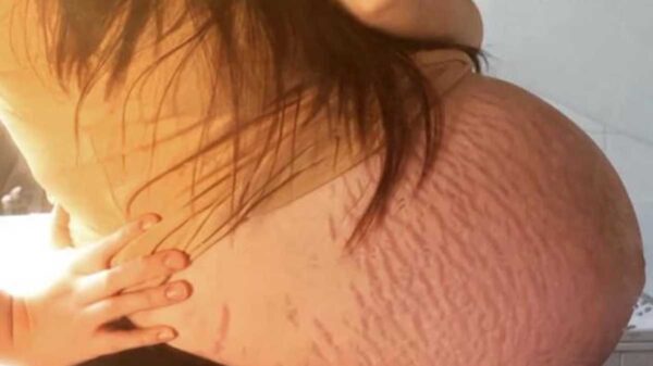 Una mujer en Reino Unido, se llevó la sorpresa de su vida, pues los médicos le informaron que tendría gemelos, pero la historia cambió el día del parto.