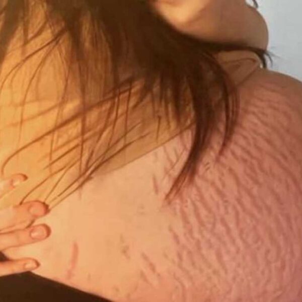 Una mujer en Reino Unido, se llevó la sorpresa de su vida, pues los médicos le informaron que tendría gemelos, pero la historia cambió el día del parto.