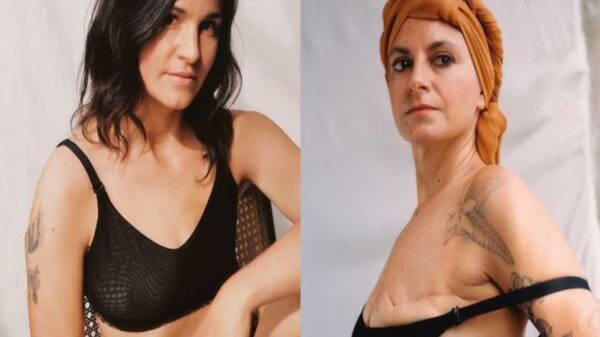 La empresa de modas Mango, crearon una colección de trajes de baño para mujeres sobrevivientes de cáncer de mamá