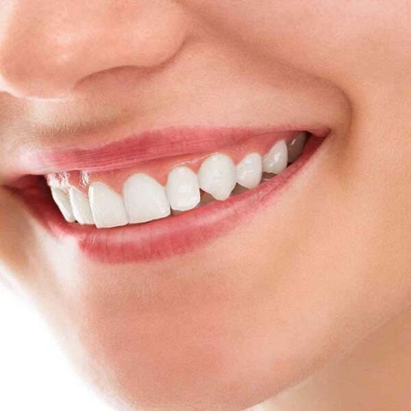 Luego de analizar las causas genéticas de las personas que tienen demasiados dientes investigadores japoneses buscan cómo obtener su regeneración en adultos