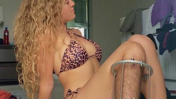 Las burlas se desataron en internet por la  publicación de la foto de una joven llamada Millie Maclay, quien luce una pierna sin depilar