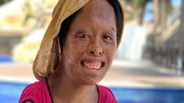 En redes sociales se viraliza el caso de Juanita, quien a los 12 años fue golpeada, quemada y vendida por su propio padre