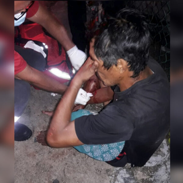 Trio de perros pitbull "ajustician" a presunto ladrón en Cozumel