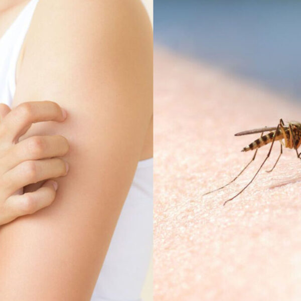 Remedios caseros para las picaduras de mosquitos