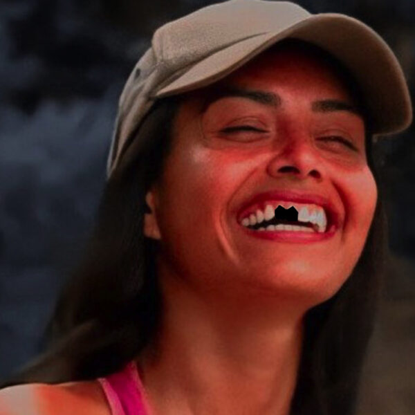 Survivor México 2021: Kristal Silva sufre terrible golpe y pierde un diente