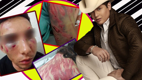 El cantante Remmy Valenzuela es acusado de golpear a su primo y a otra mujer