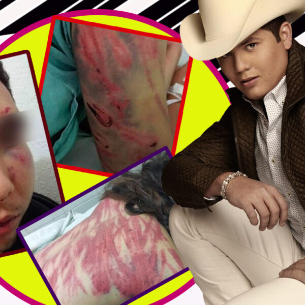 El cantante Remmy Valenzuela es acusado de golpear a su primo y a otra mujer