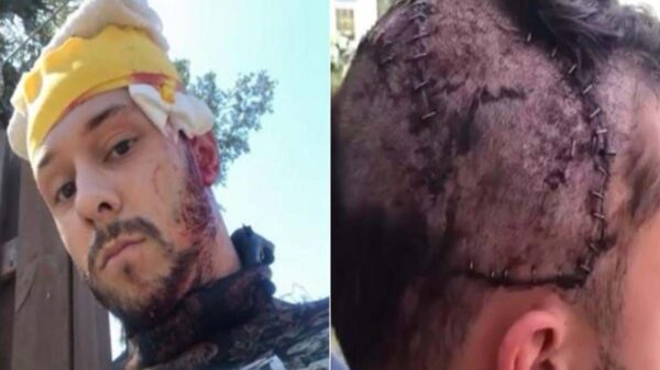 Un cocodrilo de tres metros de largo atacó a un buzo en el río Mayakka y pese a que le mordió la cabeza logró sobrevivir