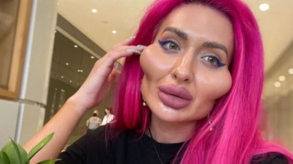 Anastasia Pokreshchu, ha ganado notoriedad debido a la peculiar forma de su rostro; tiene los pómulos más grandes del mundo