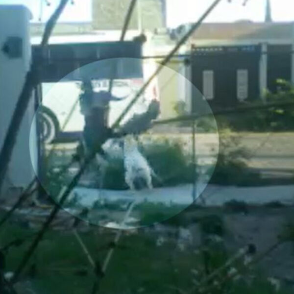 Menor de 11 años es atacado por un perro pitbull en la calle