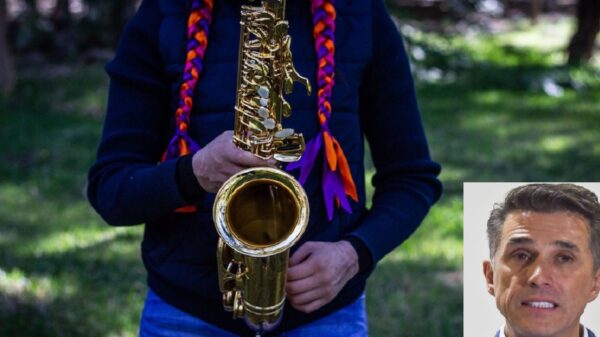 Acusa saxofonista agredida con ácido a Mayer: es “oportunista”