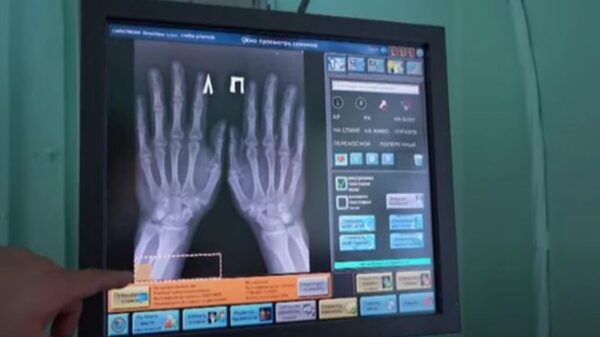 Con el fin de facilitarse la vida un médico de 40 años se implantó cinco microchips y de esta forma puede realizar multifunciones