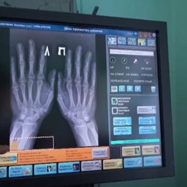 Con el fin de facilitarse la vida un médico de 40 años se implantó cinco microchips y de esta forma puede realizar multifunciones