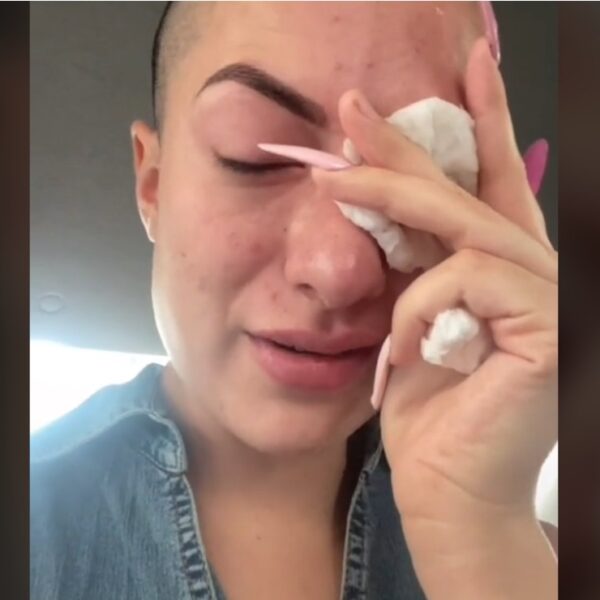 Mujer se pone pegamento en los ojos creyendo que eran gotas oculares