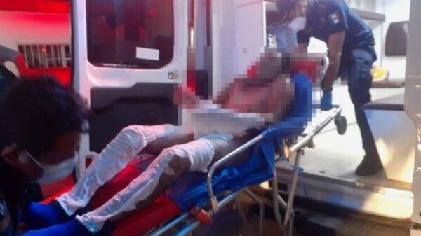 A días de prenderse fuego frente a su familia, fallece en el hospital de Tizimín joven de 24 años