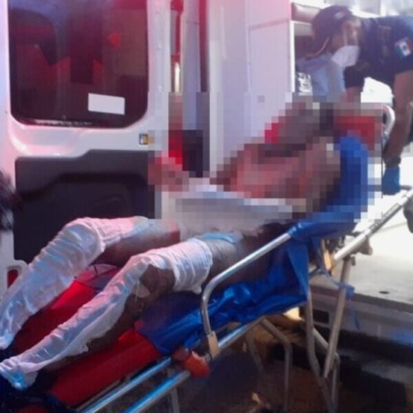 A días de prenderse fuego frente a su familia, fallece en el hospital de Tizimín joven de 24 años