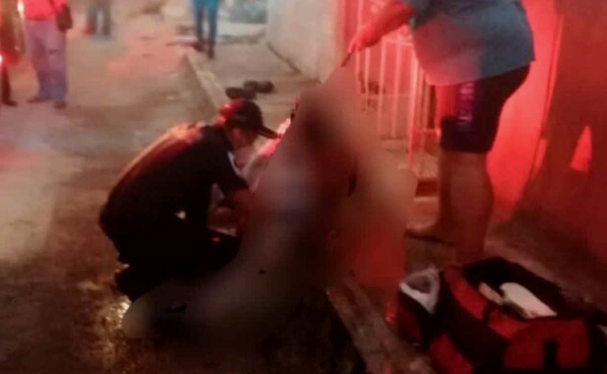 A días de prenderse fuego frente a su familia, fallece en el hospital de Tizimín joven de 24 años