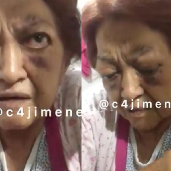 Brindan apoyo a abuelita de 85 años, maltratada por su hijo