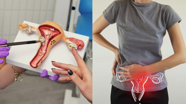 ¡Alertan! Mujeres de entre 25 y 35 años podrían tener cáncer cervicouterino