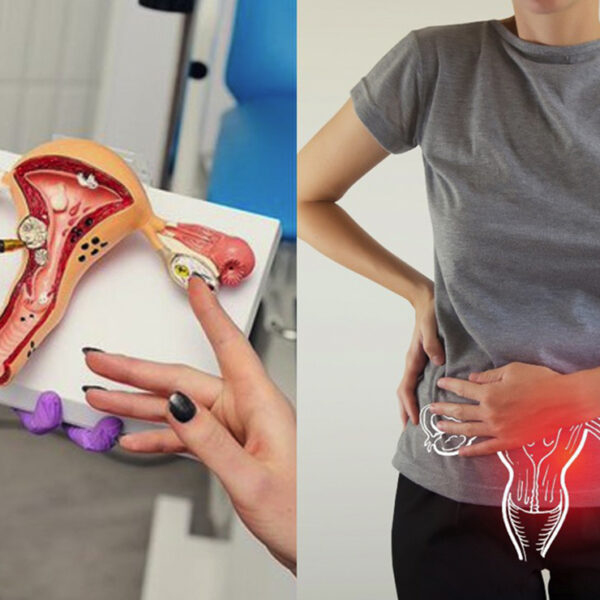 ¡Alertan! Mujeres de entre 25 y 35 años podrían tener cáncer cervicouterino