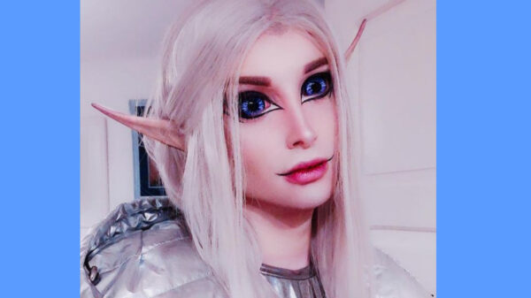 Modelo argentino se sometió a 32 cirugías estéticas para ser a un elfo